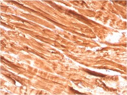 Biotium&nbsp;Dystrophin (DMD) (Marker of Duchenne and Becker Muscular Dystrophy)(DMD/3242), CF640R conjugate, 0.1mg/mL