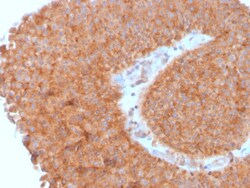 Biotium&nbsp;PAI-RBP1 / SERBP1 / SERPINE1(SERBP1/3495), CF640R conjugate, 0.1mg/mL