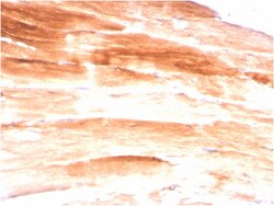 Biotium&nbsp;Dystrophin (DMD) (Marker of Duchenne and Becker Muscular Dystrophy)(DMD/3245), CF405S conjugate, 0.1mg/mL