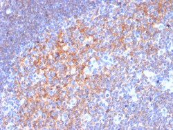 Biotium&nbsp;CD19 (B-Lymphocyte Marker)(CD19/3116), CF640R conjugate, 0.1mg/mL