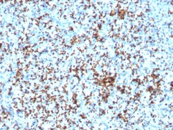 Biotium&nbsp;CD61 / Integrin 3 / Platelet Glycoprotein IIIa (Platelet Marker)(ITGB3/3126R), CF640R conjugate, 0.1mg/mL