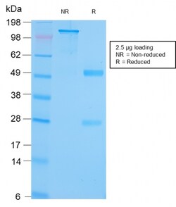 Biotium&nbsp;GRP94 / HSP90B1(Glucose-Regulated Protein 94) (Endoplasmic Reticulum Marker)(HSP90B1/3168R), CF647 conjugate, 0.1mg/mL