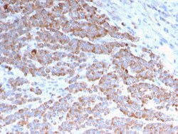 Biotium&nbsp;Cytokeratin 18 (KRT18)(rKRT18/1190), CF647 conjugate, 0.1mg/mL