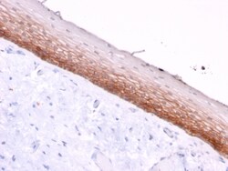 Biotium&nbsp;CD44v4/5 (Marker of Tumor Metastasis)(3D2), CF640R conjugate, 0.1mg/mL