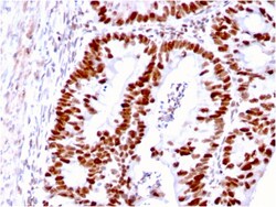 Biotium&nbsp;MSH6 (DNA Mismatch Repair Protein)(MSH6/3085), CF640R conjugate, 0.1mg/mL
