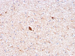 Biotium&nbsp;Serum Amyloid P / APCS(APCS/3240), CF405S conjugate, 0.1mg/mL