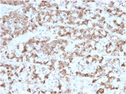 Biotium&nbsp;Prolactin (Pituitary Tumor Marker)(PRL/2910), CF568 conjugate, 0.1mg/mL