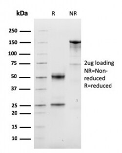 Biotium&nbsp;Cyclin D1 (G1-Cyclin & Mantle Cell Lymphoma Marker)(CCND1/3548), CF640R conjugate, 0.1mg/mL