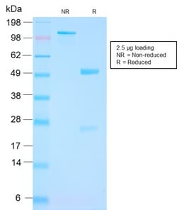 Biotium&nbsp;FOLH1 / PSMA (Prostate Epithelial Marker)(FOLH1/3149R), CF594 conjugate, 0.1mg/mL