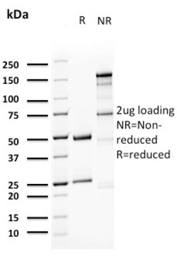 Biotium&nbsp;Uroplakin 1A (Urothelial Differentiation Marker)(UPK1A/2923), CF488A conjugate, 0.1mg/mL