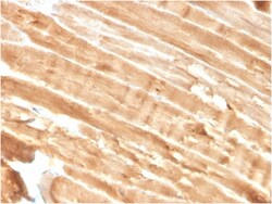 Biotium&nbsp;Dystrophin (DMD) (Marker of Duchenne and Becker Muscular Dystrophy)(DMD/3244), CF594 conjugate, 0.1mg/mL