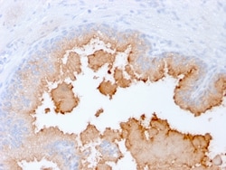 Biotium&nbsp;AMACR / p504S (Prostate Cancer Marker)(rAMACR/1864), CF594 conjugate, 0.1mg/mL