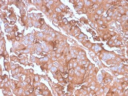 Biotium&nbsp;MUC1 / CA15-3 / EMA / CD227 (Epithelial Marker)(MUC1/2980R), CF740 conjugate, 0.1mg/mL