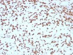 Biotium&nbsp;Cathepsin D (Tumor Marker)(CTSD/3275), CF594 conjugate, 0.1mg/mL