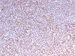 Biotium&nbsp;ALK (Anaplastic Lymphoma Kinase) / CD246(ALK/3218R), CF594 conjugate, 0.1mg/mL