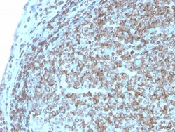Biotium&nbsp;CD74 (B-Cell Marker)(CLIP/3127R), CF594 conjugate, 0.1mg/mL