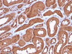 Biotium&nbsp;MTAP (Tumor Suppressor Marker)(MTAP/3137R), Biotin conjugate, 0.1mg/mL