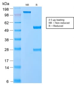 Biotium&nbsp;VLDL-Receptor (Very Low Density Lipoprotein Receptor)(VLDLR/2896R), CF405S conjugate, 0.1mg/mL