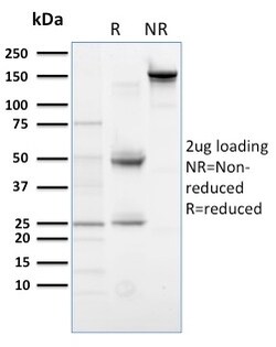 Biotium&nbsp;PLK1 (Marker of Mitosis)(AZ44), CF594 conjugate, 0.1mg/mL