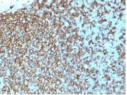 Biotium&nbsp;HLA-Pan (MHC II)(rHLA-Pan/3475), CF594 conjugate, 0.1mg/mL