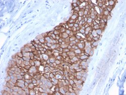 Biotium&nbsp;HER-2 / c-erbB-2 / neu / CD340(ERBB2/3092), CF640R conjugate, 0.1mg/mL