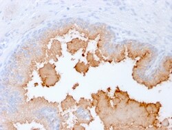 Biotium&nbsp;AMACR / p504S (Prostate Cancer Marker)(rAMACR/1864), CF488A conjugate, 0.1mg/mL