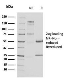 Biotium&nbsp;Uroplakin 1A (Urothelial Differentiation Marker)(UPK1A/2924), Biotin conjugate, 0.1mg/mL