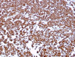 Biotium&nbsp;CD20 / MS4A1 (B-Cell Marker)(MS4A1/3409), CF740 conjugate, 0.1mg/mL