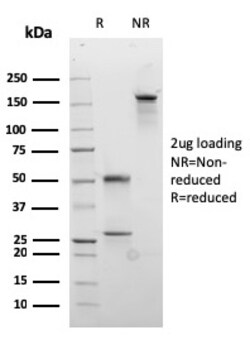 Biotium&nbsp;Desmocollin-2/3(rDSC2/3437), CF647 conjugate, 0.1mg/mL