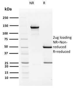 Biotium&nbsp;HPV16 E2 (Human Papilloma Virus 16)(TVG 261), CF488A conjugate, 0.1mg/mL
