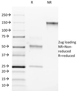 Biotium&nbsp;ROR-gamma / RORC (RAR-related Orphan Receptor C)(RORC/2942), CF594 conjugate, 0.1mg/mL