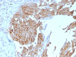 Biotium&nbsp;Uroplakin 1B (Urothelial Differentiation Marker)(UPK1B/3102), CF594 conjugate, 0.1mg/mL