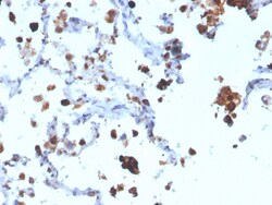 Biotium&nbsp;Napsin A (Lung Adenocarcinoma Marker)(NAPSA/3308), CF594 conjugate, 0.1mg/mL