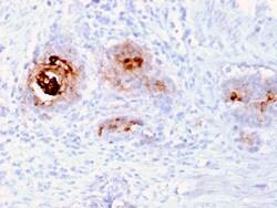 Biotium&nbsp;TAG-72 / CA72.4 (Tumor-Associated Glycoprotein)(rB72.3), CF594 conjugate, 0.1mg/mL