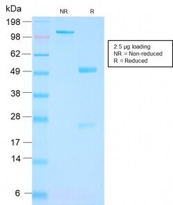 Biotium&nbsp;FOLH1 / PSMA (Prostate Epithelial Marker)(FOLH1/3149R), CF640R conjugate, 0.1mg/mL