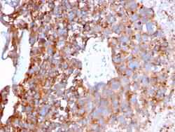 Biotium&nbsp;Uroplakin 1B (Urothelial Differentiation Marker)(UPK1B/3273), CF640R conjugate, 0.1mg/mL