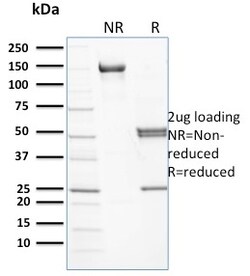 Biotium&nbsp;Spectrin beta I (SPTB)(RG/26), CF594 conjugate, 0.1mg/mL