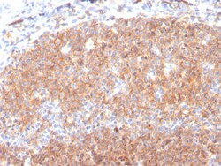Biotium&nbsp;CD19 (B-Lymphocyte Marker)(CD19/3117), CF594 conjugate, 0.1mg/mL
