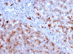 Biotium&nbsp;Cathepsin D (Tumor Marker)(CTSD/3083), CF594 conjugate, 0.1mg/mL