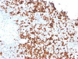 Biotium&nbsp;Granzyme B (NK/T-Cell Lymphoma Marker)(GZMB/3056), 0.2mg/mL