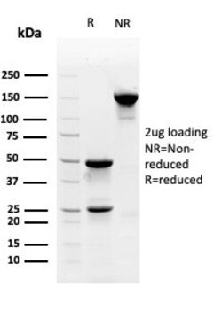 Biotium&nbsp;Myofibroblast Marker(PR 2D3), Biotin conjugate, 0.1mg/mL