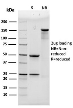 Biotium&nbsp;Alpha Actinin 4 / ACTN4(93), CF647 conjugate, 0.1mg/mL