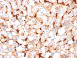 Biotium&nbsp;C1QB / Complement C1q B-Chain(C1QB/2966), 0.2mg/mL