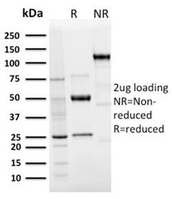 Biotium&nbsp;Langerin / CD207 (Marker of Langerhans Cells)(LGRN/3136R), CF640R conjugate, 0.1mg/mL