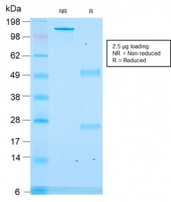 Biotium&nbsp;ACTH (Adrenocorticotrophic Hormone) (C-Terminus)(rCLIP/1418), CF640R conjugate, 0.1mg/mL