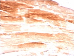 Biotium&nbsp;Dystrophin (DMD) (Marker of Duchenne and Becker Muscular Dystrophy)(DMD/3245), CF640R conjugate, 0.1mg/mL