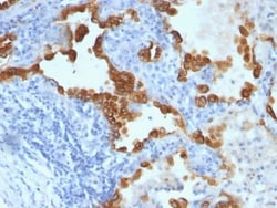 Biotium&nbsp;Cytokeratin 8/18(B22.1 + B23.1), 0.2mg/mL