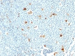 Biotium&nbsp;Calprotectin (MRP14)(S100A9)(CPT/1028), 0.2mg/mL