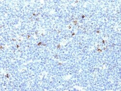 Biotium&nbsp;HLA-Aw32 & HLA-A25 (MHC I)(CATA-1), CF640R conjugate, 0.1mg/mL