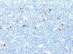 Biotium&nbsp;HLA-Aw32 & HLA-A25 (MHC I)(CATA-1), CF640R conjugate, 0.1mg/mL